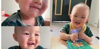 『突发荨麻疹』11M20d+ 宝宝脸颊、耳下、下巴、脖子突然发出一颗一颗红疹,宝宝红疹观察重点,食物过敏红疹