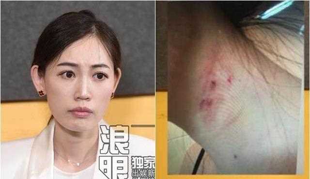 大逆转！马蓉首受访「和宋喆不熟」爆王宝强才是出轨男