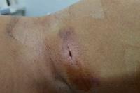 枪枝走火误伤老公，陈仙梅再暴哭：又开始喷血