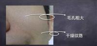 你的肌肤正处于慢性过敏？因为过度护肤！如何正确的护肤！