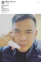 手指被割伤爆血！窦智孔「皮肤一块翻起来」…晒照曝复原进度