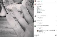 手指被割伤爆血！窦智孔「皮肤一块翻起来」…晒照曝复原进度