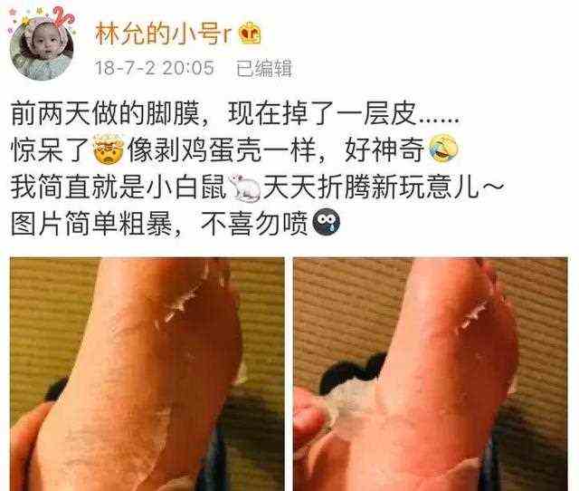 林允同款足膜别再用了！行业大揭秘，敏感、干燥、脚气它竟是元凶