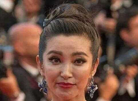 女星为何不敢打“玻尿酸”抗老，副作用太可怕，还是美容仪更安全