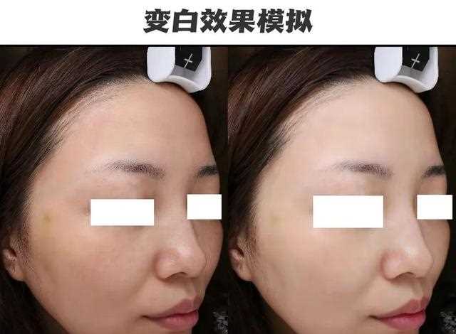 美白不摆烂！教你全方位实现亮白好皮肤，内有「避坑指南」