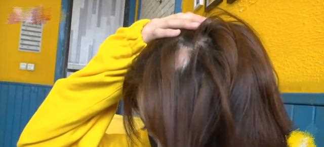 20岁美女理发店花接发，没想到接发不成，头顶反倒全秃了