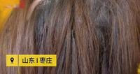 20岁美女理发店花接发,没想到接发不成,头顶反倒全秃了 20岁美女理发店花接发,没想到接发不成,头顶反倒全秃了