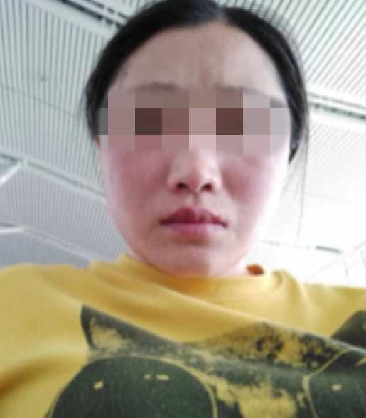 女子花12000元在“荣美会”做祛斑 她说“被严重毁容”了