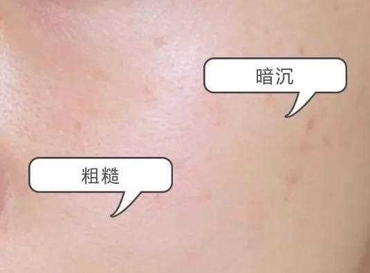 皱纹、皮肤松弛、暗沉怎么办？抗衰老护肤品选择攻略，好用到犯规