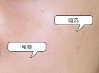 皱纹、皮肤松弛、暗沉怎么办？抗衰老护肤品选择攻略，好用到犯规