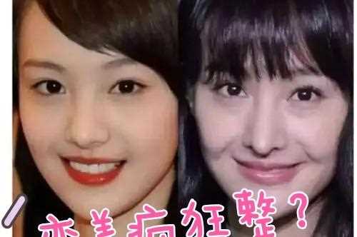 郑爽“大动干戈”成这样，想变美可不能做疯女孩儿