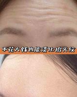 李佳琦诚不欺我！月薪1500也能成功淡化抬头纹