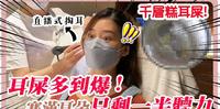 惊！耳屎多到只剩一半听力！千层糕耳屎.......港妹体验直播式掏耳朵