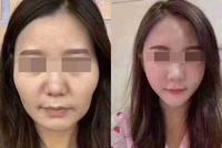二胎宝妈产后暴瘦,面部松弛下垂,我给她设计方案后立马元气满满 二胎宝妈产后暴瘦,面部松弛下垂,我给她设计方案后立马元气满满