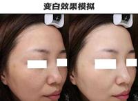 05f3f83a-5208-440d-b84c-338e14775ad4_1.jpg-s 美白不摆烂!教你多方位实现亮白好皮肤,内有「避坑指南」
