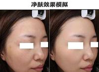 05f3f83a-5208-440d-b84c-338e14775ad4_2.jpg-s 美白不摆烂!教你多方位实现亮白好皮肤,内有「避坑指南」