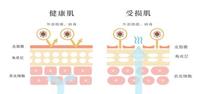 保湿还在用水?快试试“以油养肤” 保湿还在用水?快试试“以油养肤”