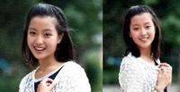 金喜善整容后遗症爆发，网友吐槽：脸残嘴歪一点都没有之前的样子