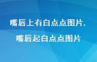 嘴唇起白点点图片【100句文案】