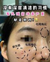 亲测!刘昊然、宋茜都觉得好用,这几款清洁面膜你真的不能错过鸭 亲测!刘昊然、宋茜都觉得好用,这几款清洁面膜你真的不能错过鸭