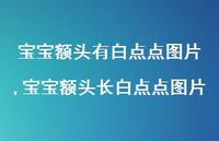 宝宝额头长白点点图片【100句文案】 宝宝额头长白点点图片【100句文案】
