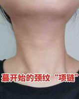 平价去颈纹妙招~维A+凡士林,去颈纹绝绝子 平价去颈纹妙招~维A+凡士林,去颈纹绝绝子