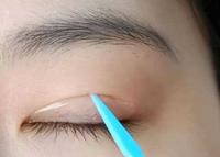 单眼皮女生喜提双眼皮,只因巧用了双眼皮贴的另一种方法 单眼皮女生喜提双眼皮,只因巧用了双眼皮贴的另一种方法