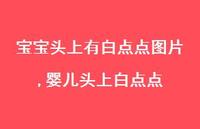婴儿头上白点点【100句文案】 婴儿头上白点点【100句文案】