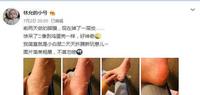 ca7fdffd-a7bb-4f65-88bb-0a6ced6c613b_1.jpg-s 林允的“换皮足膜”是在交智商税?吃瓜群众:不如学孙俪泡脚靠谱