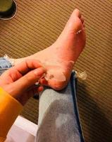 ca7fdffd-a7bb-4f65-88bb-0a6ced6c613b_2.jpg-s 林允的“换皮足膜”是在交智商税?吃瓜群众:不如学孙俪泡脚靠谱