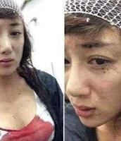 d8c3878e-9ac8-4243-a846-009ca205dd1e_2.jpg-s 有名女星李依晓聚会上被狗咬毁容,朋友无人理睬,事业进入低谷期