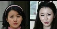 整容的明星,有人塌房,断送演艺之路。有人如获新生,从此开挂 整容的明星,有人塌房,断送演艺之路。有人如获新生,从此开挂